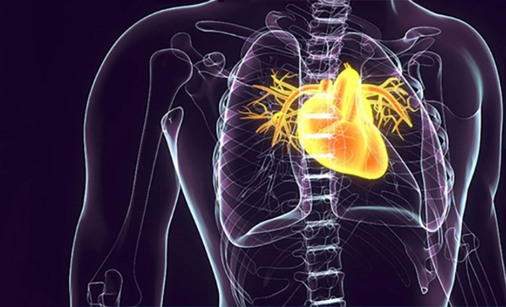 Illustration of heart in chest for cardiac care elearning module