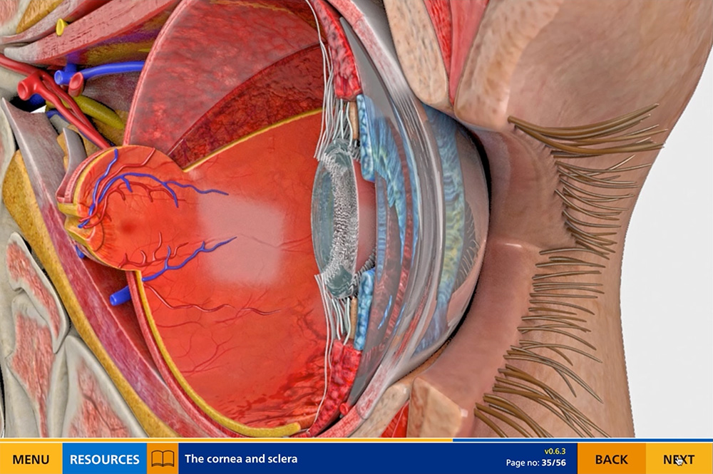 Cross section of eye for a CPD elearning module on Opthalmology