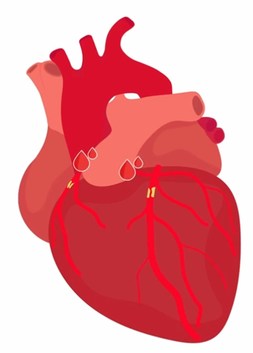 Illustration of heart for cardiac care elearning module