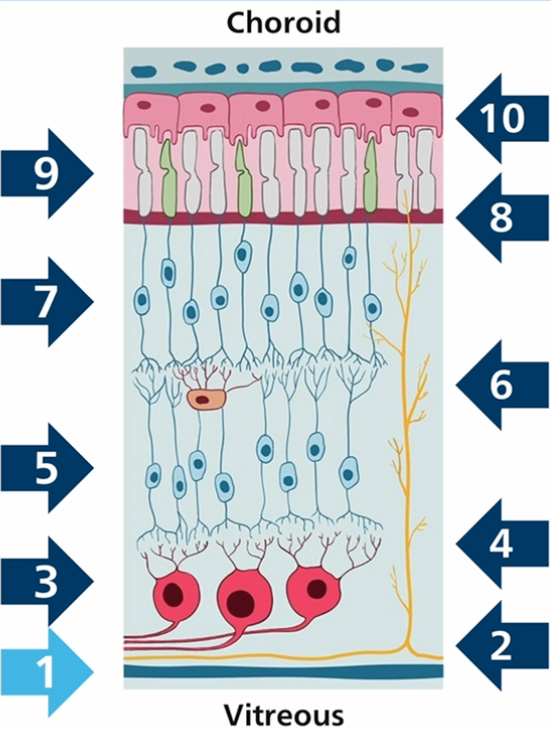 screenshot of elearning module on Opthalmology showing retina layers