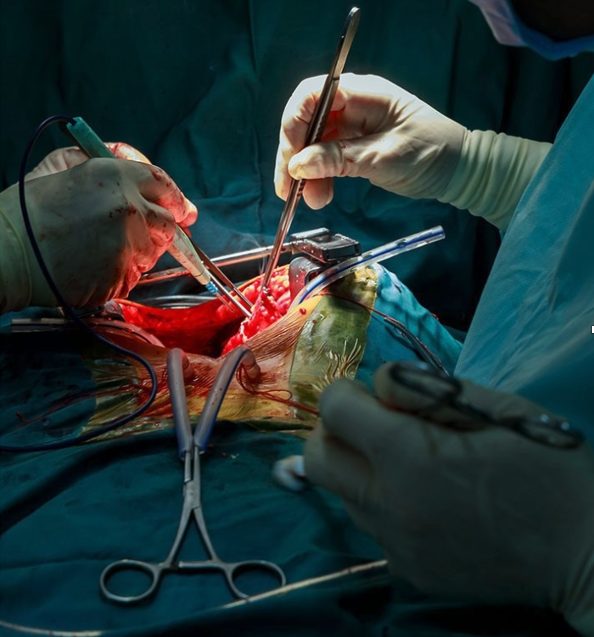 Image of heart surgery for cardiac care elearning module