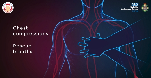 Animated graphic of someone performing CPR